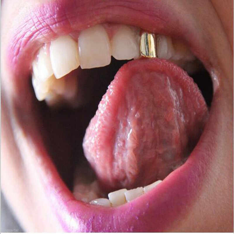 ฝาครอบฟันปลอมแบบเดี่ยว 1-3 ชิ้ - Body Jewelry Gold Plated บทวิจารณ์และราคา